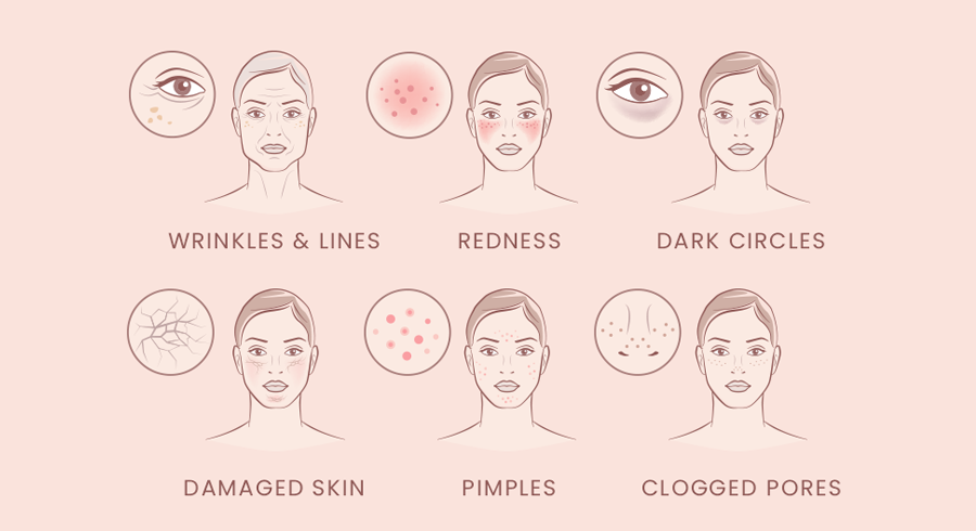 Easy Face Yoga Exercises to Add to Your Skin-Care Routine